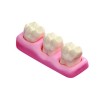 :: AMERICAN DENTAL SUPPLY, INC. -   GIANT PERIO MODEL FOR DEMONSTRATION - 4 TIMES NATURAL SIZE ::