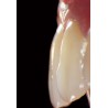 SILHOUETTE® DENTINES, B1, 100 GM